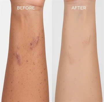 /%D7%A2%D7%99%D7%A1%D7%95%D7%99-%D7%A4%D7%A0%D7%99%D7%9D-%D7%A7%D7%95%D7%91%D7%99%D7%93%D7%95.htm